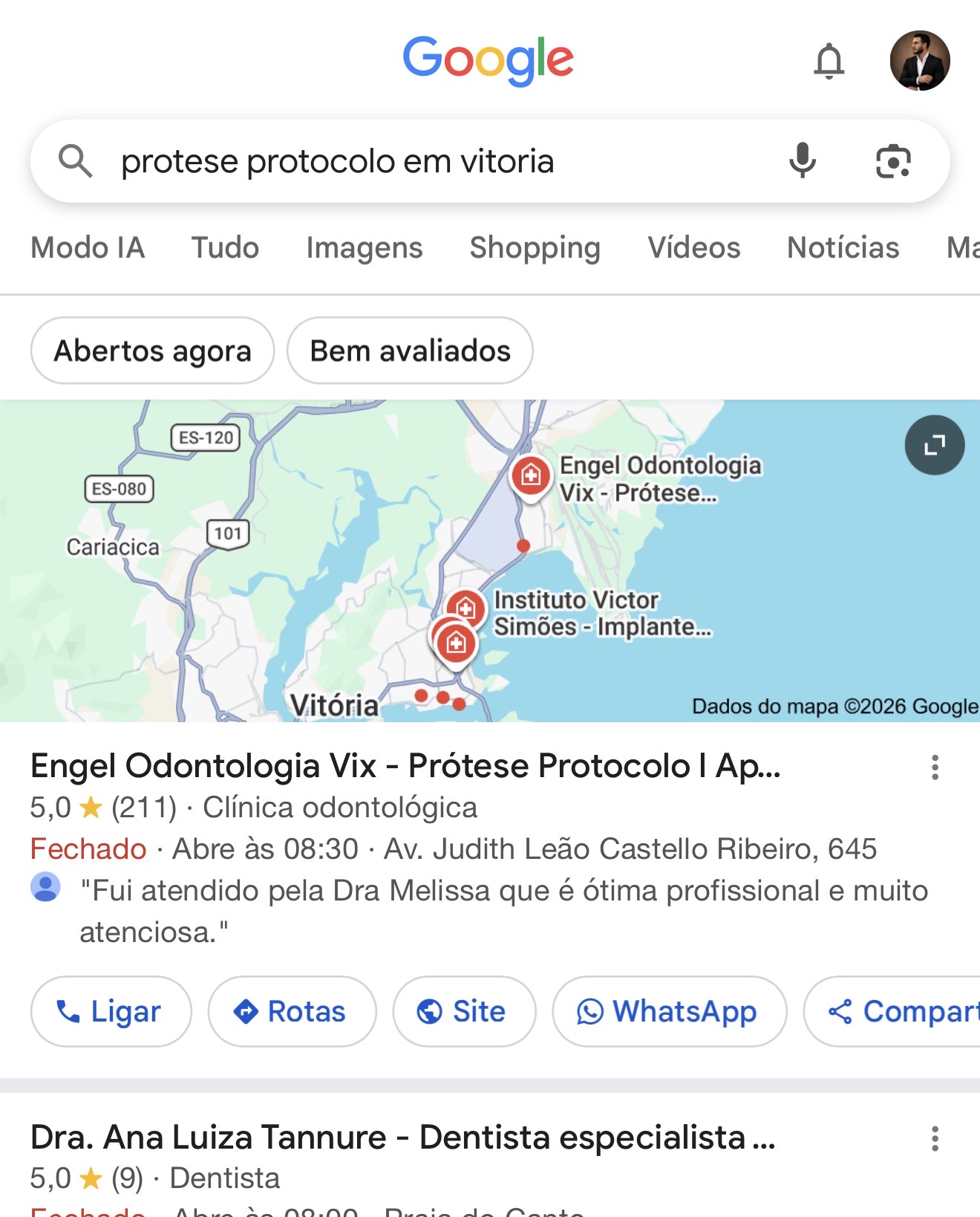 Print real da busca prótese protocolo em Vitória: Engel Odontologia aparece como primeiro resultado local